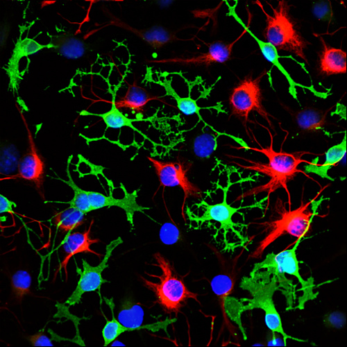 Adult Neural Stem Cell 102